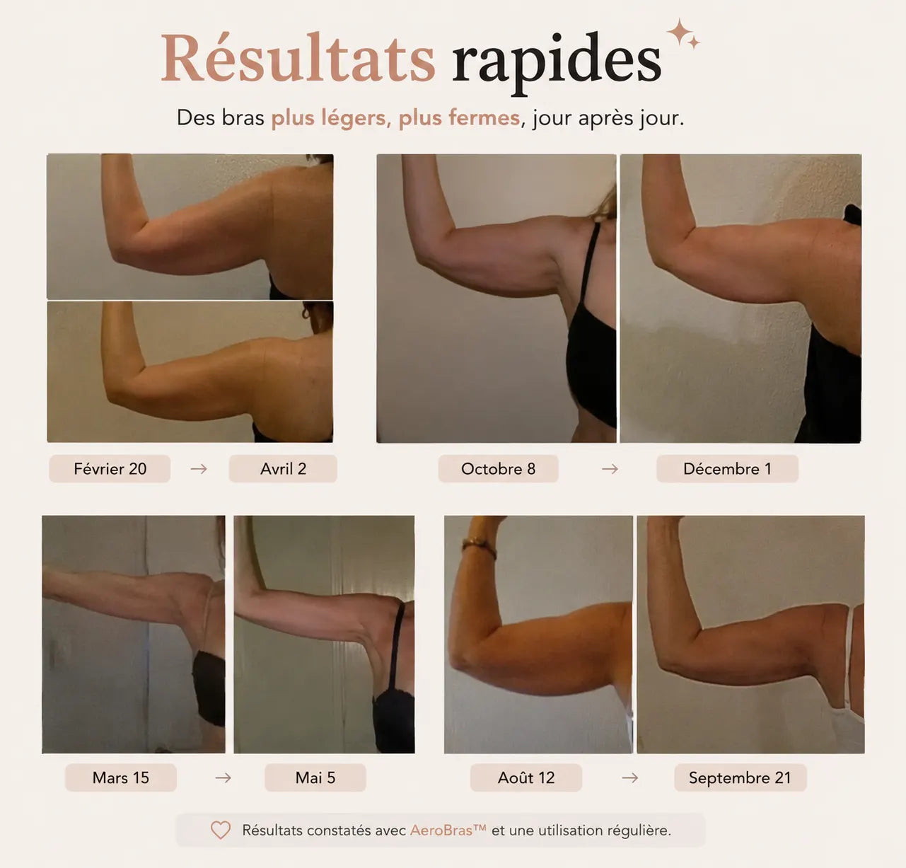 AeroBras™ - Les Manchons Anti-Gonflement pour les Bras